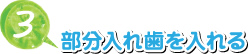 3. 部分入れ歯を入れる